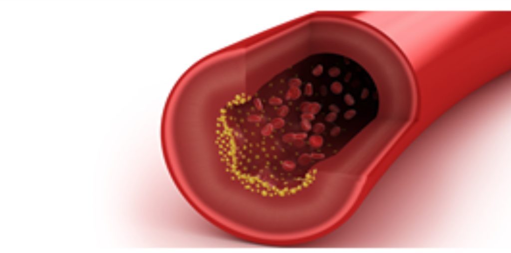 cholesterol