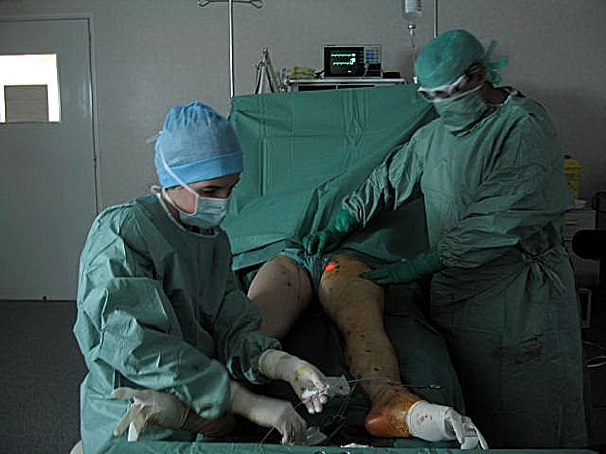 Centre Traitement Varices le BOULOU (traitement micro-invasif des varices: Laser endoveineux, en occitanie Perpignan le BOULOU