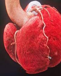 Le coroscanner (ou scanner cardiaque) permet de réaliser des images en coupes très fines du muscle cardiaque et de ses vaisseaux (notamment les artères coronaires). Les images sont très précises. Elles peuvent montrer des détails de l'ordre du millimètre.